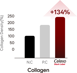 对比图表显示使用Celexo Black Label后胶原蛋白增加134%